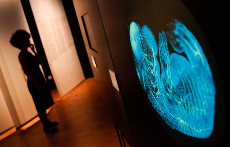 Il morbo di Alzheimer può essere diagnosticato con anni di anticipo