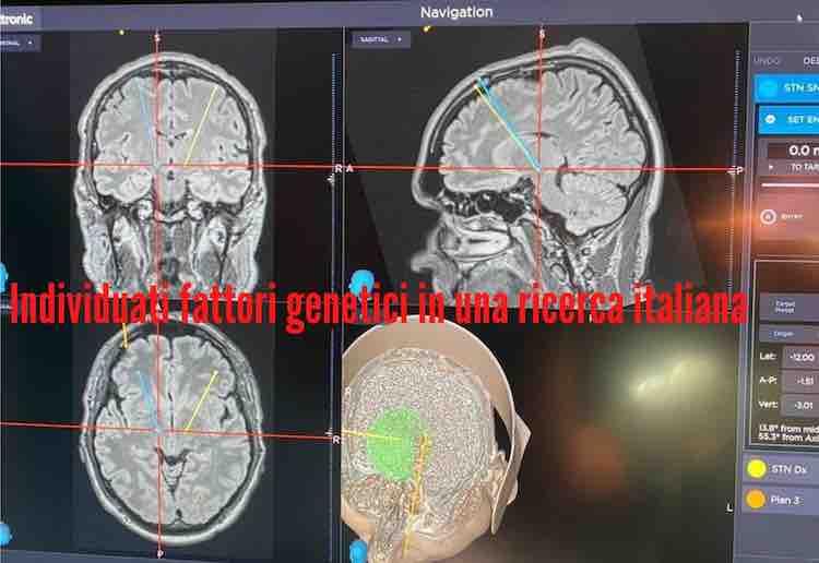 Fattori genetici Neuroblastoma